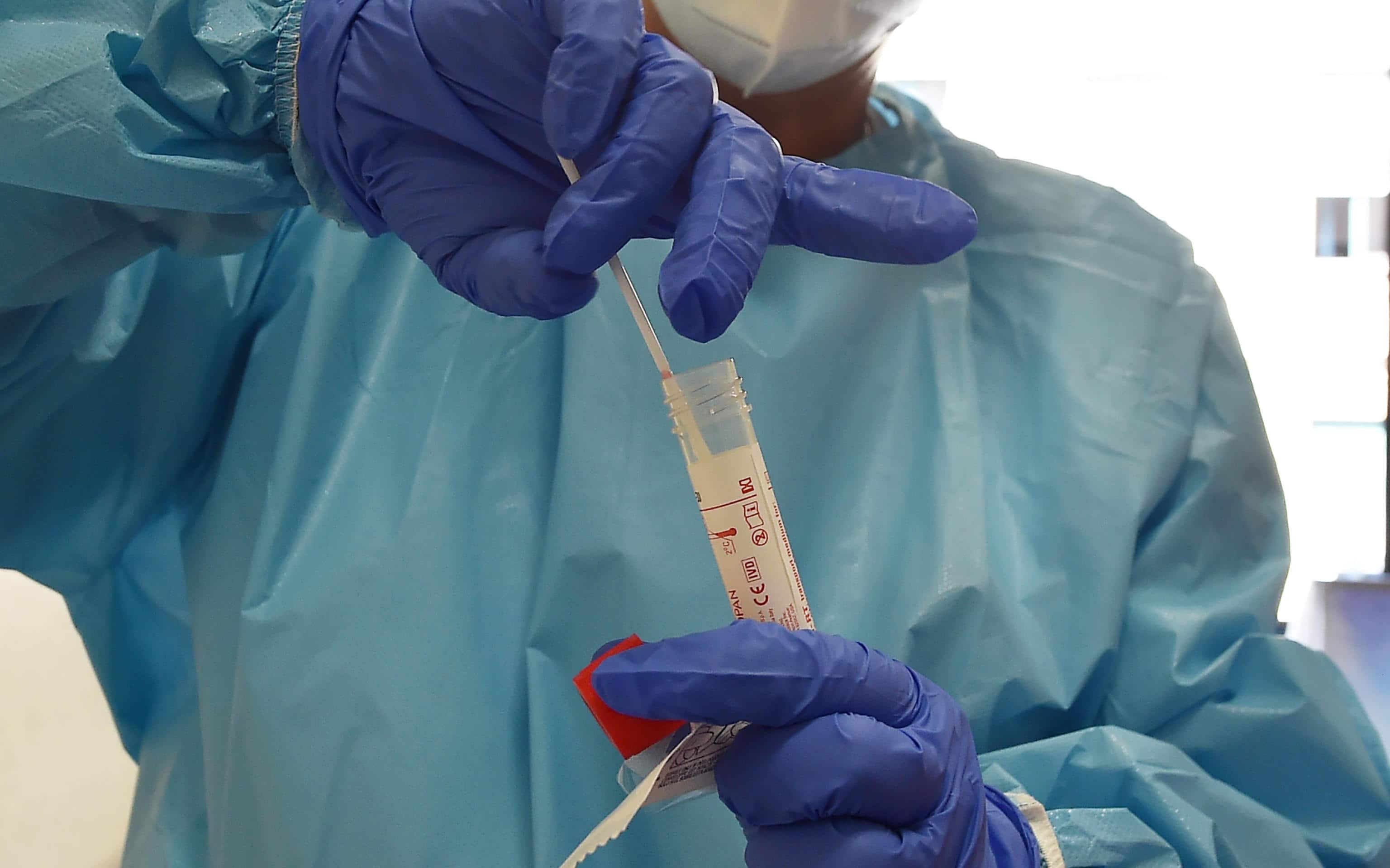 Un'addetta sanitaria dell ospedale Molinette effettua un tampone a una persona rientrata dalle ferie trascorese all estero, Torino, 23 agosto 2020 ANSA/ALESSANDRO DI MARCO