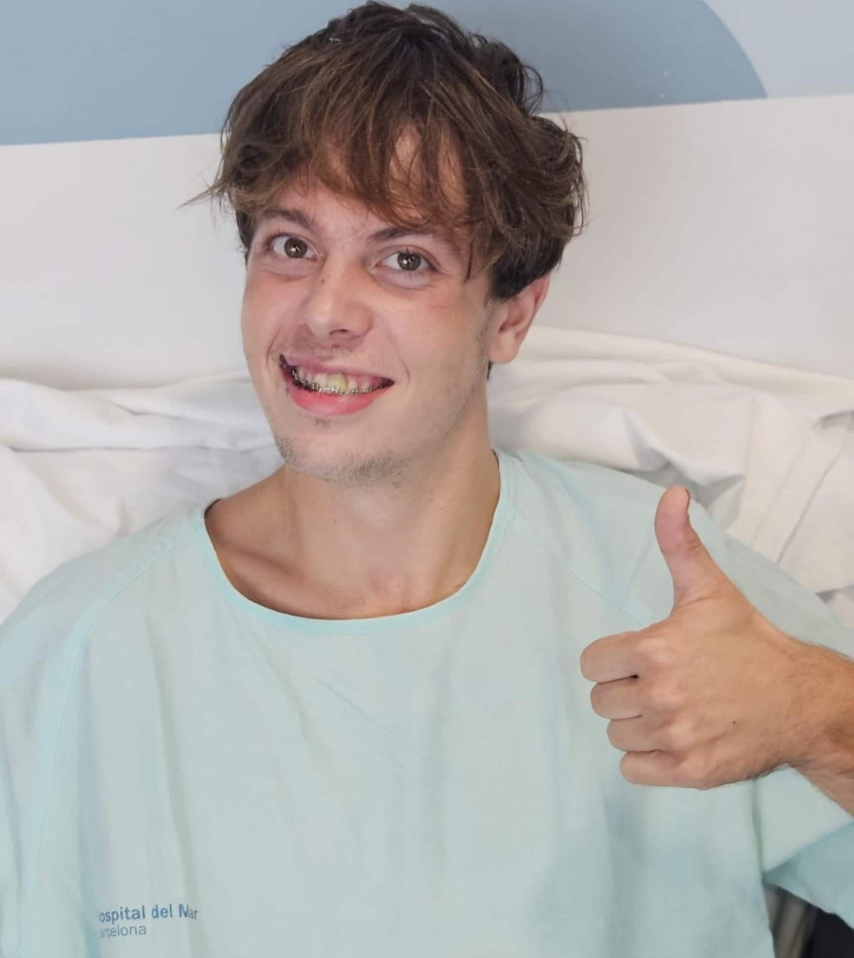 Nicola Maggiotto il ragazzo di 21 anni di Asolo (Treviso) rimasto gravemente                  ferito nel corso di un'aggressione a Barcellona (Spagna) la sera del 12 agosto scorso, Ã¨ tornato a camminare. 27 agosto 2026. ANSA + NO SALES - EDITORIAL USE ONLY + NPK
