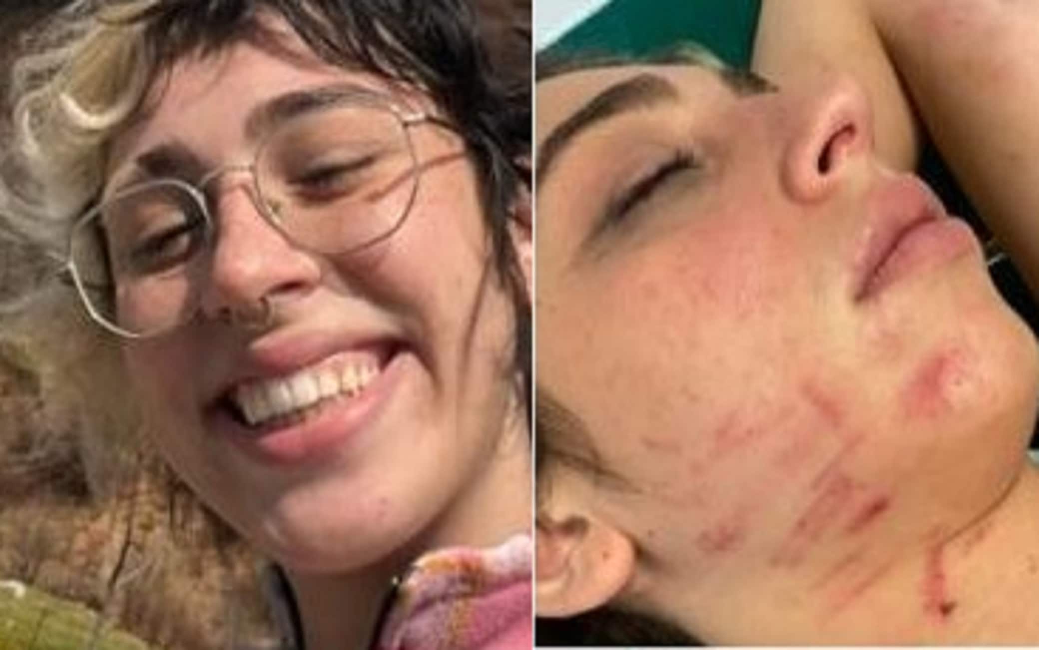 Le immagini condivise dalla ragazza e pubblicate dal Corriere