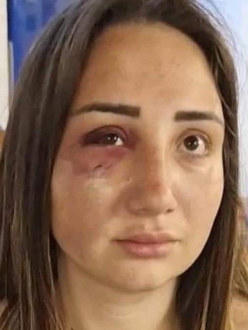 Gaia, vittima dell'aggressione a Bacoli.