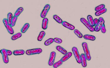 H78XNF CLOSTRIDIUM DIFFICILE