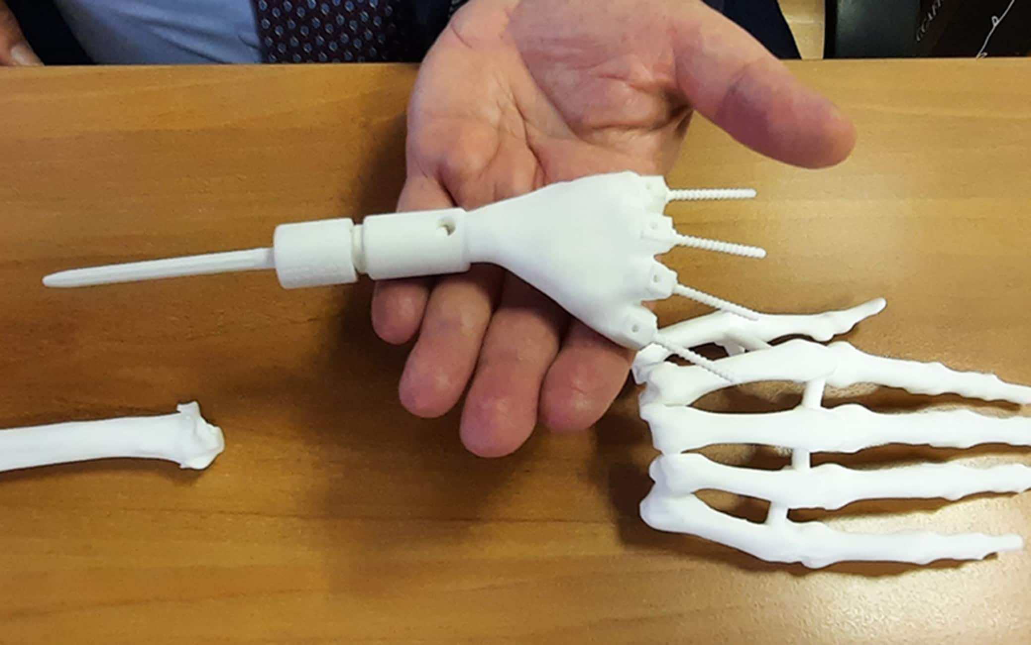 Il polso ricostruito con la stampante 3D