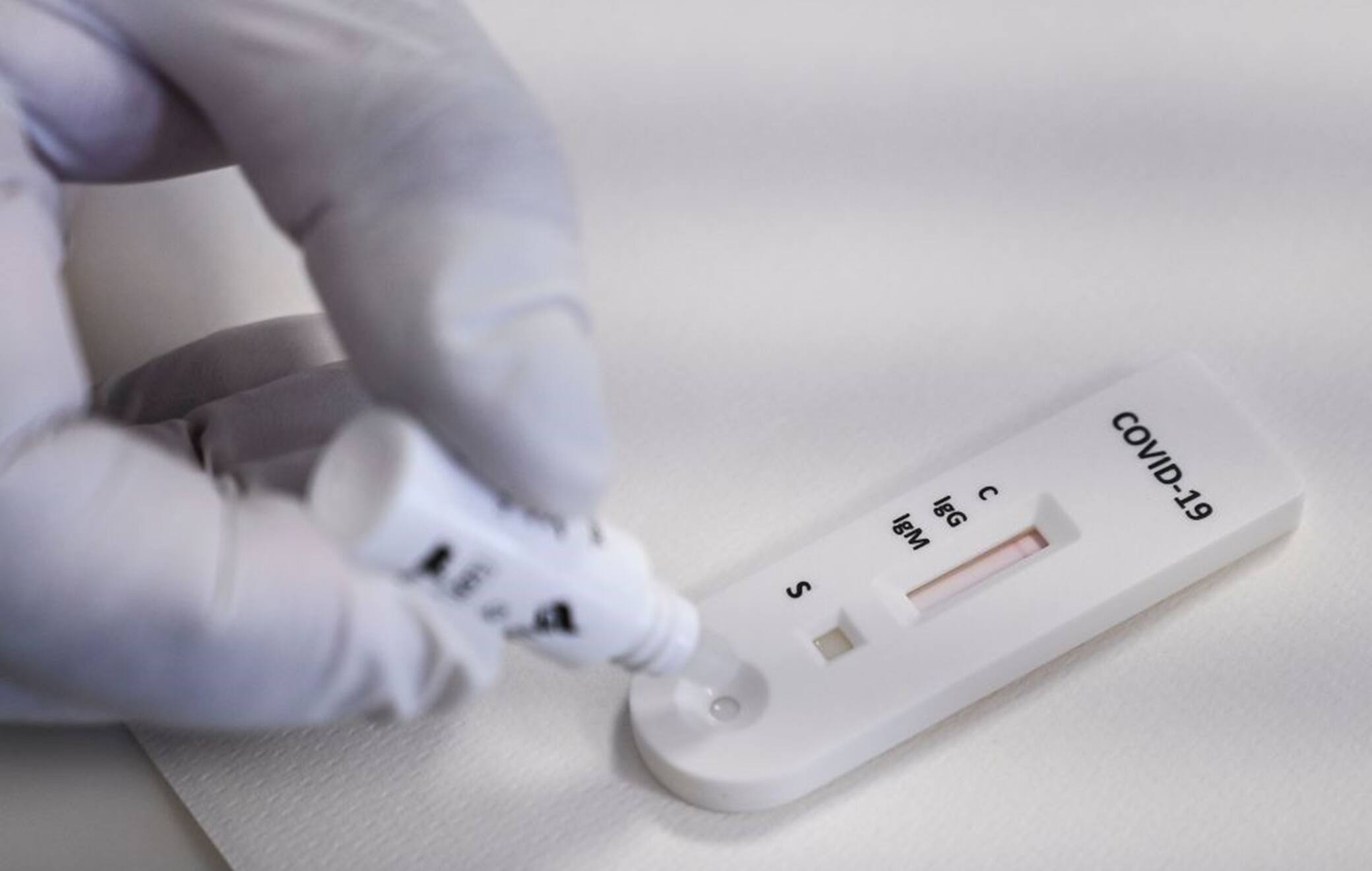 CATANIA, ITALY - MAY 22: A rapid serological test is carried out in the molecular biology laboratory of Cannizzaro Hospital on May 22, 2020 in Catania, Italy. Restaurants, bars, cafes, hairdressers and other shops have reopened, subject to social distancing measures, after more than two months of a nationwide lockdown meant to curb the spread of Covid-19. (Photo by Fabrizio Villa/Getty Images)