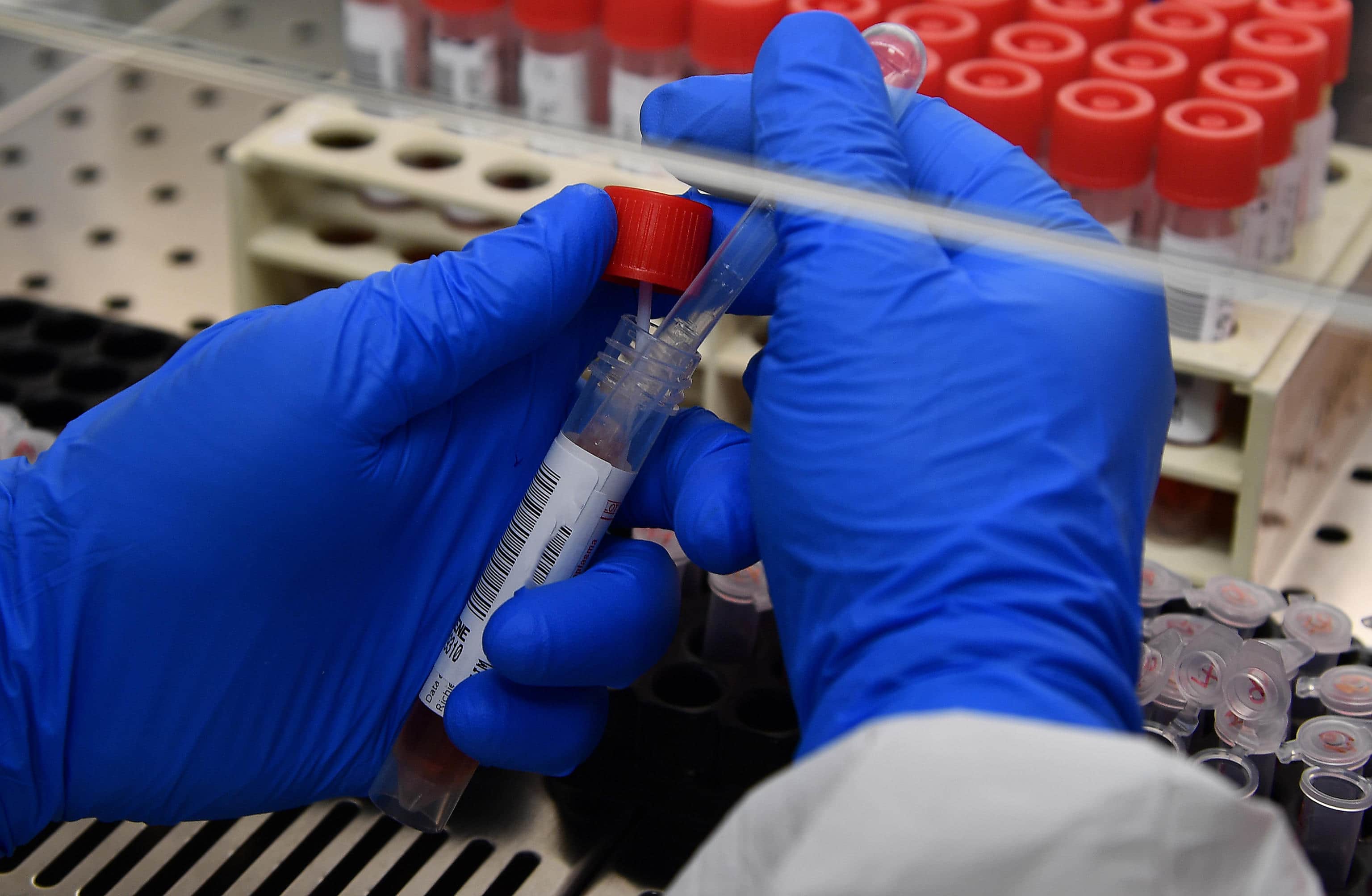 Un dottore processa i tamponi test Covid-19 effettuati sui pazienti, nel laboratorio del Policlinico S.Martino. Genova, 26 Maggio 2020 ANSA/LUCA ZENNARO