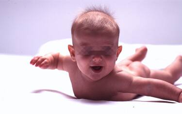 Neonato