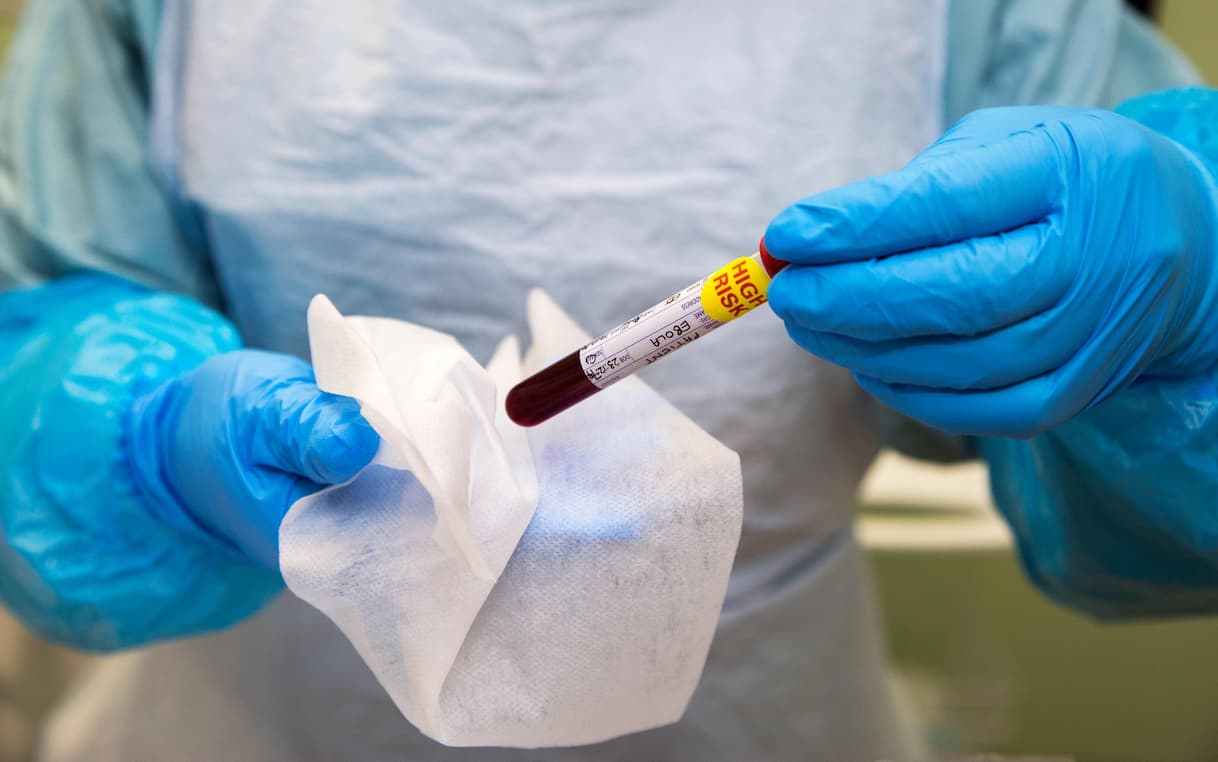Ebola Outbreak: Italy Announces 5 Levels of Risk and Measures to Combat the Virus