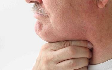 Mal di gola 