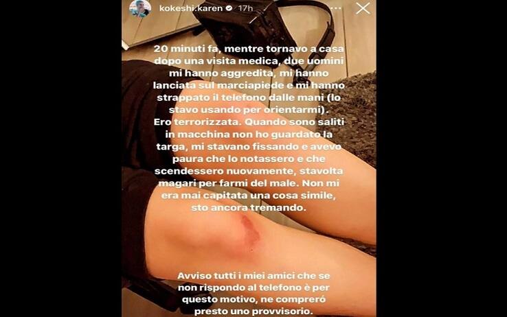 La storia Instagram di Karek Kokeshi in cui racconta l'aggressione e la rapina