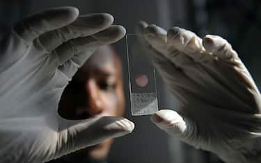 GettyImages-Malaria