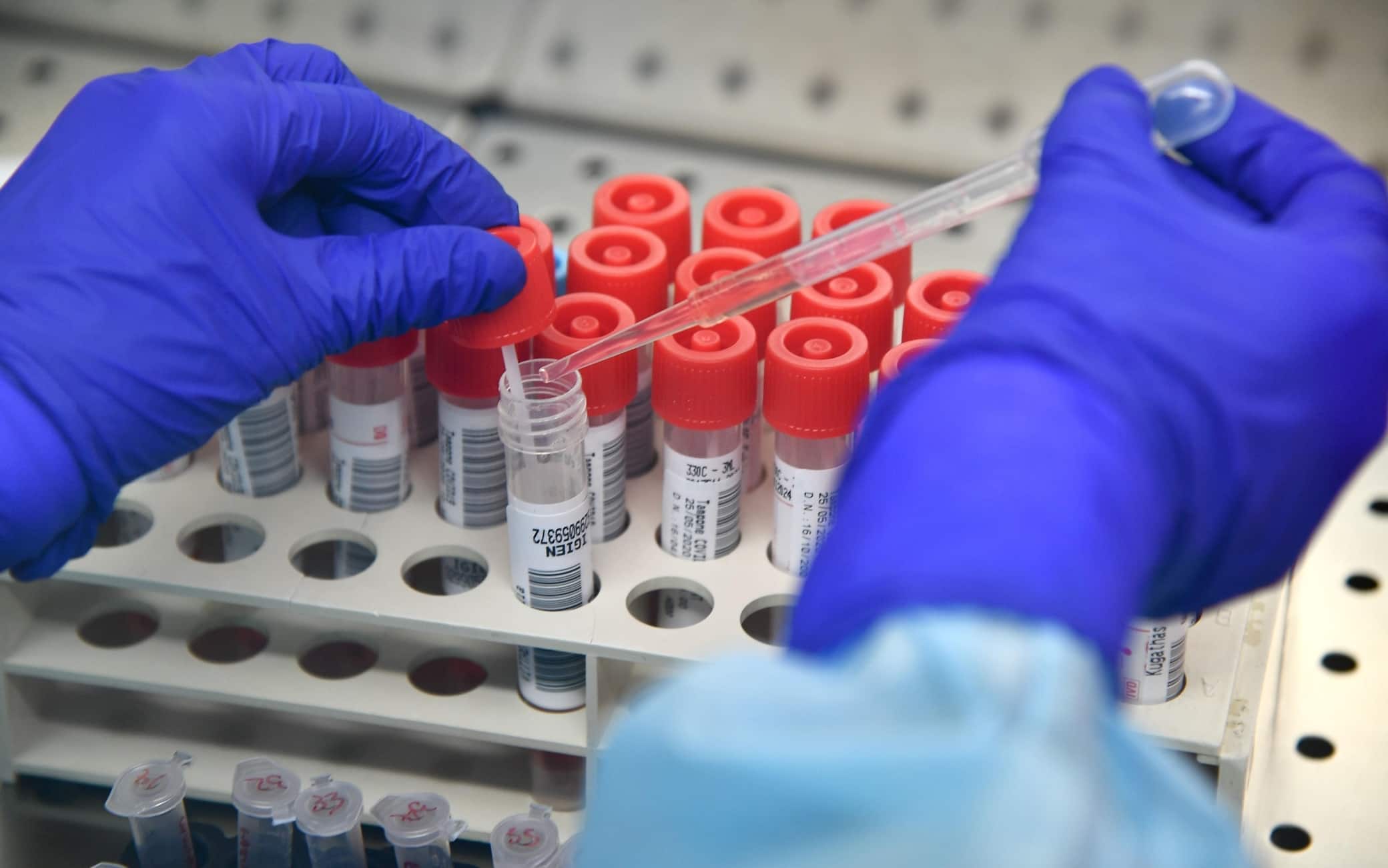 Un dottore processa i tamponi test Covid-19 effettuati sui pazienti, nel laboratorio del Policlinico S.Martino. Genova, 26 Maggio 2020 ANSA/LUCA ZENNARO