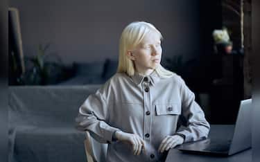 Medium portrait of beautiful young woman with albinism sitting at desk in front of laptop in loft living room at home looking away