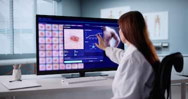 Melanoma