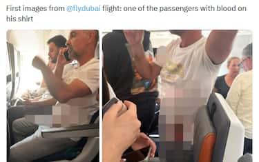 In una foto da X, un passeggero del volo FlyDubai con la maglietta macchiata di sangue