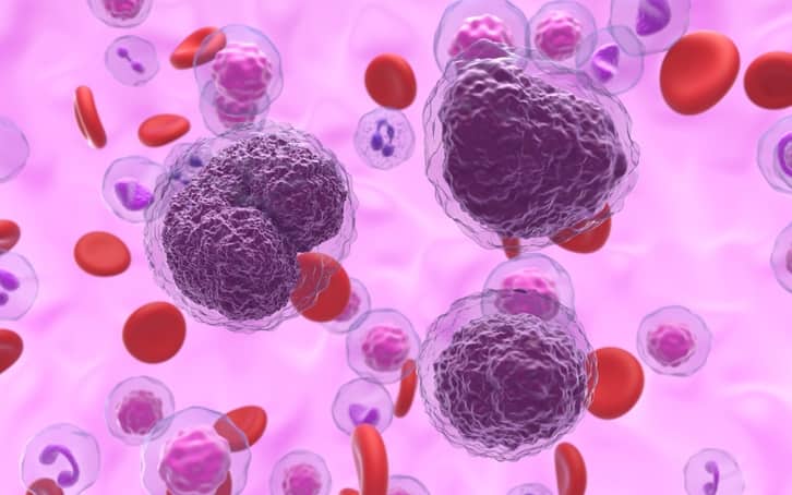 Linfoma di Hodgkin, nuove prospettive dalle terapie