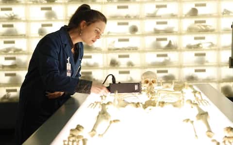 Bones