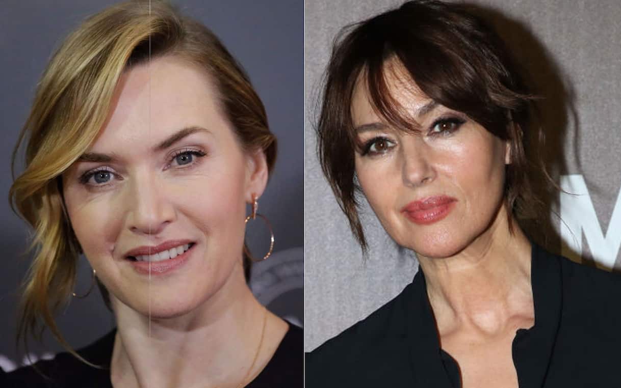 Chirugia estetica, 20 attrici che hanno detto no al botox: da Kate ...