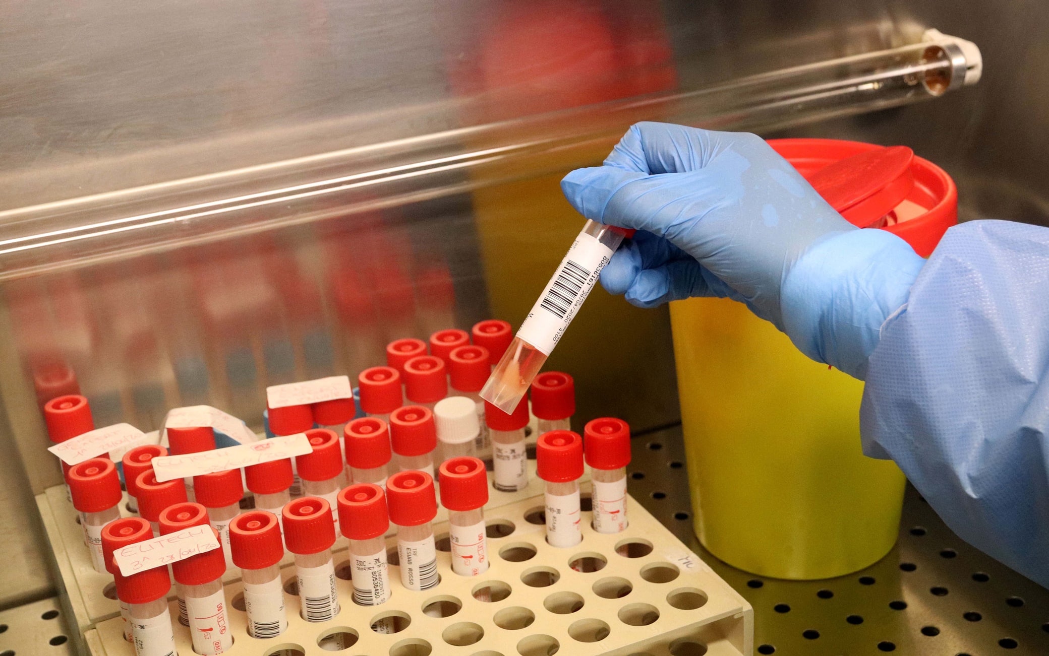 Medical biologists and laboratory technicians wearing protective gear working with swabs samples in a laboratory of Microbiology and Virology, where tests for SARS-CoV-2 which causes the COVID-19 disease are conducted for suspected cases.. on April 28, 2020 in Milan, Italy. Photo by Clemente Marmorino/Eyepix/ABACAPRESS.COM (Marmorino Clemente/Eyepix/ABACA / IPA/Fotogramma, Milan - 2020-04-28) p.s. la foto e' utilizzabile nel rispetto del contesto in cui e' stata scattata, e senza intento diffamatorio del decoro delle persone rappresentate